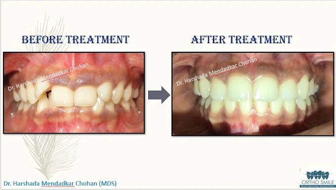 Patient Smile